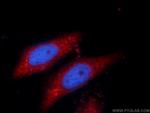 SPAG16 Antibody in Immunocytochemistry (ICC/IF)