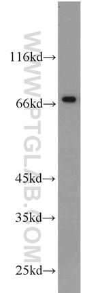 SPAG16 Antibody in Western Blot (WB)