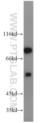 SPAG16 Antibody in Western Blot (WB)