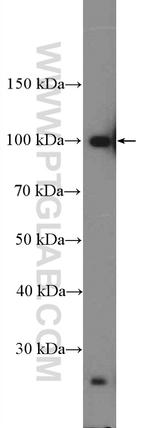 TSR1 Antibody in Western Blot (WB)