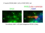 RPGR Antibody in Immunocytochemistry (ICC/IF)