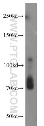 RPGR Antibody in Western Blot (WB)