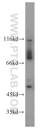 RPGR Antibody in Western Blot (WB)