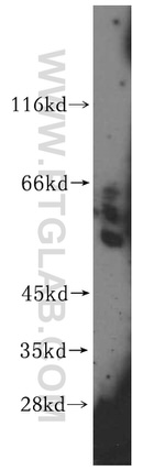 GPT Antibody in Western Blot (WB)