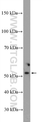GPT Antibody in Western Blot (WB)