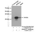 HMGCL Antibody in Immunoprecipitation (IP)