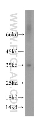 HMGCL Antibody in Western Blot (WB)