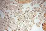 GALNTL2 Antibody in Immunohistochemistry (Paraffin) (IHC (P))