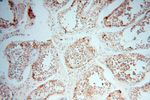 GALNTL2 Antibody in Immunohistochemistry (Paraffin) (IHC (P))