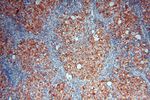 GALNTL2 Antibody in Immunohistochemistry (Paraffin) (IHC (P))