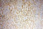 NDUFB1 Antibody in Immunohistochemistry (Paraffin) (IHC (P))