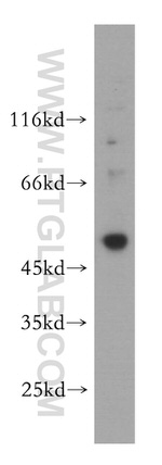 UBR7 Antibody in Western Blot (WB)