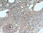 UNC13D/Munc13-4 Antibody in Immunohistochemistry (Paraffin) (IHC (P))