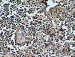 UNC13D/Munc13-4 Antibody in Immunohistochemistry (Paraffin) (IHC (P))