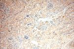 UNC13D/Munc13-4 Antibody in Immunohistochemistry (Paraffin) (IHC (P))