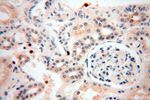 UNC13D/Munc13-4 Antibody in Immunohistochemistry (Paraffin) (IHC (P))