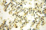 UNC13D/Munc13-4 Antibody in Immunohistochemistry (Paraffin) (IHC (P))