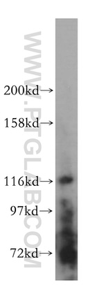 UNC13D/Munc13-4 Antibody in Western Blot (WB)