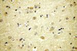 PIGT Antibody in Immunohistochemistry (Paraffin) (IHC (P))