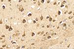 PIGT Antibody in Immunohistochemistry (Paraffin) (IHC (P))