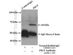 PIGT Antibody in Immunoprecipitation (IP)