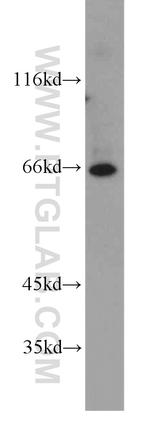 PIGT Antibody in Western Blot (WB)