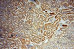 CES1 Antibody in Immunohistochemistry (Paraffin) (IHC (P))