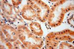 CES1 Antibody in Immunohistochemistry (Paraffin) (IHC (P))