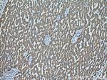 CES1 Antibody in Immunohistochemistry (Paraffin) (IHC (P))