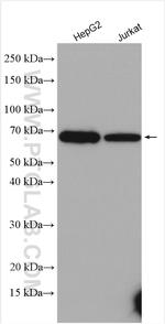 CES1 Antibody in Western Blot (WB)