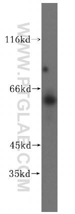 CES1 Antibody in Western Blot (WB)