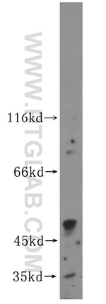 Kir6.2 Antibody in Western Blot (WB)