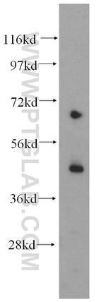 Kir6.2 Antibody in Western Blot (WB)