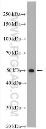 Kir6.2 Antibody in Western Blot (WB)