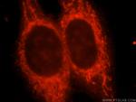 Kir6.2 Antibody in Immunocytochemistry (ICC/IF)