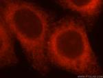 ATL3 Antibody in Immunocytochemistry (ICC/IF)