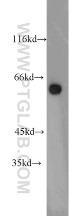 ATL3 Antibody in Western Blot (WB)