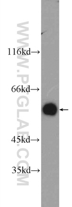 ATL3 Antibody in Western Blot (WB)