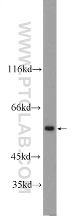 ATL3 Antibody in Western Blot (WB)