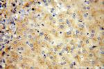 vitamin D binding protein Antibody in Immunohistochemistry (Paraffin) (IHC (P))