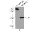 HSD17B7 Antibody in Immunoprecipitation (IP)