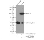 AP1B1 Antibody in Immunoprecipitation (IP)