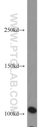 AP1B1 Antibody in Western Blot (WB)