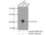 AP1B1 Antibody in Immunoprecipitation (IP)