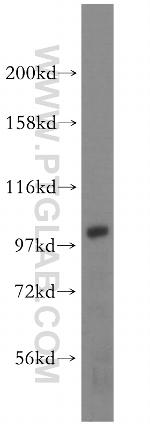 AP1B1 Antibody in Western Blot (WB)