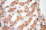 GALNT14 Antibody in Immunohistochemistry (Paraffin) (IHC (P))