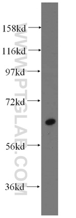 GALNT14 Antibody in Western Blot (WB)