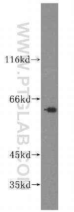 GALNT14 Antibody in Western Blot (WB)