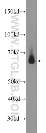 GALNT14 Antibody in Western Blot (WB)