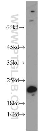 CPLX3 Antibody in Western Blot (WB)